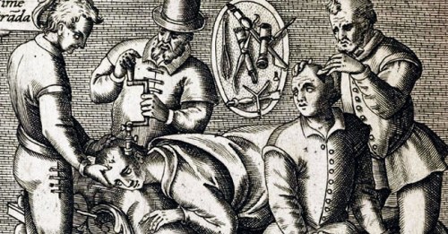 L0041513 Trepanning being performed